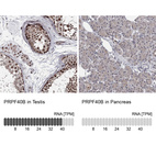 Anti-PRPF40B Antibody