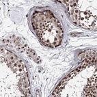 Immunohistochemical staining of human testis shows high expression.