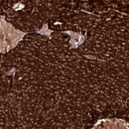Immunohistochemical staining of human parathyroid gland shows strong cytoplasmic positivity in glandular cells.