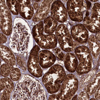 Anti-REXO2 Antibody