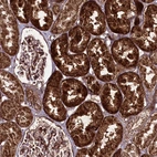 Immunohistochemical staining of human kidney shows strong cytoplasmic positivity in cells in tubules.