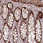Immunohistochemical staining of human colon shows strong cytoplasmic positivity in glandular cells.