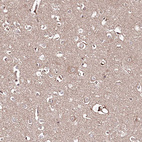 Immunohistochemical staining of human cerebral cortex shows weak cytoplasmic positivity in neuronal cells.