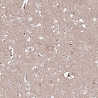 Anti-REXO2 Antibody