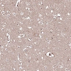 Immunohistochemical staining of human cerebral cortex shows weak cytoplasmic positivity in neuronal cells.