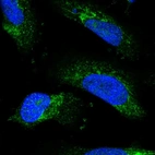 Immunofluorescent staining of human cell line U-251 MG shows positivity in mitochondria.