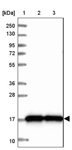 Lane 1: Marker [kDa] 250, 130, 95, 72, 55, 36, 28, 17, 10_br/_Lane 2: Human cell line RT-4_br/_Lane 3: Human cell line U-251MG sp