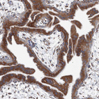 Anti-RCN1 Antibody