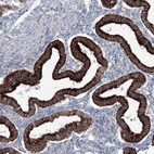 Immunohistochemical staining of human endometrium shows strong cytoplasmic positivity in glandular cells.