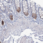 Anti-RCN1 Antibody