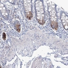Immunohistochemical staining of human small intestine shows moderate cytoplasmic positivity in Paneth cells.