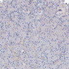 Anti-RCN1 Antibody