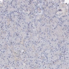 Immunohistochemical staining of human pancreas shows very weak cytoplasmic positivity in intercalated ducts and Islets of Langerhans.