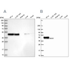 Anti-RCN1 Antibody