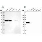 Western blot analysis using Anti-RCN1 antibody HPA038474 (A) shows similar pattern to independent antibody HPA062104 (B).