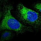 Immunofluorescent staining of human cell line U-2 OS shows localization to endoplasmic reticulum.