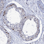 Immunohistochemical staining of human testis shows strong nuclear positivity in cells in seminiferous ducts.