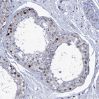 Immunohistochemical staining of human testis shows strong nuclear positivity in cells in seminiferous ducts.