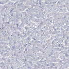 Immunohistochemical staining of human liver shows no positivity in hepatocytes as expected.