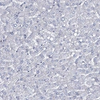 Immunohistochemical staining of human liver shows no positivity in hepatocytes as expected.
