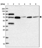 Lane 1: Marker [kDa] 250, 130, 95, 72, 55, 36, 28, 17, 10_br/_Lane 2: Human cell line RT-4_br/_Lane 3: Human cell line U-251MG sp_br/_Lane 4: Human plasma (IgG/HSA depleted)_br/_Lane 5: Human liver tissue_br/_Lane 6: Human tonsil tissue