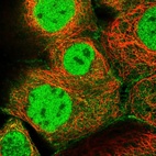 Immunofluorescent staining of human cell line A-431 shows localization to nucleoplasm, plasma membrane & cytosol.