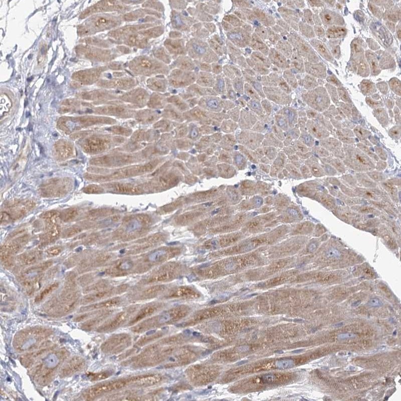 Anti-ANGPTL5 Antibody