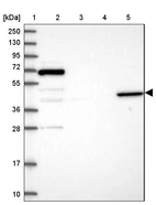 Lane 1: Marker [kDa] 250, 130, 95, 72, 55, 36, 28, 17, 10_br/_Lane 2: Human cell line RT-4_br/_Lane 3: Human cell line U-251MG sp_br/_Lane 4: Human plasma (IgG/HSA depleted)_br/_Lane 5: Human liver tissue
