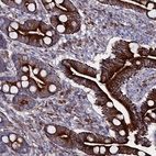 Anti-WNT8A Antibody
