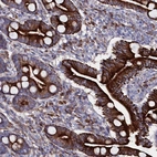 Anti-WNT8A Antibody