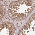 Anti-TTC12 Antibody