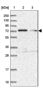 Lane 1: Marker [kDa] 250, 130, 95, 72, 55, 36, 28, 17, 10_br/_Lane 2: Human cell line RT-4_br/_Lane 3: Human cell line U-251MG sp