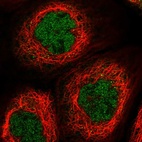 Immunofluorescent staining of human cell line A-431 shows localization to nucleoplasm.