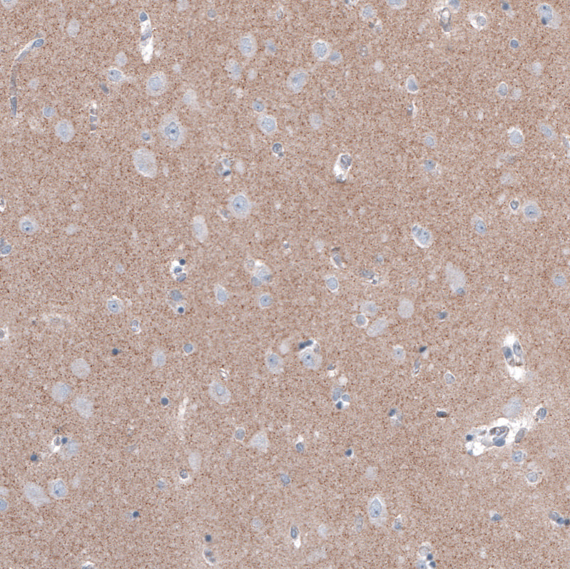 Anti-FCHSD2 Antibody