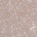 Anti-FCHSD2 Antibody