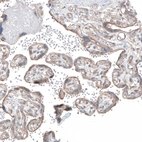 Immunohistochemical staining of human placenta shows moderate granular cytoplasmic positivity in trophoblastic cells.