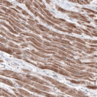 Immunohistochemical staining of human heart muscle shows moderate granular cytoplasmic positivity.