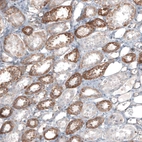 Immunohistochemical staining of human kidney shows moderate granular cytoplasmic positivity in cells in tubules.