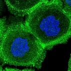 Immunofluorescent staining of human cell line A-431 shows localization to nuclear speckles, plasma membrane & actin filaments.