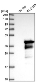 Anti-CCDC59 Antibody