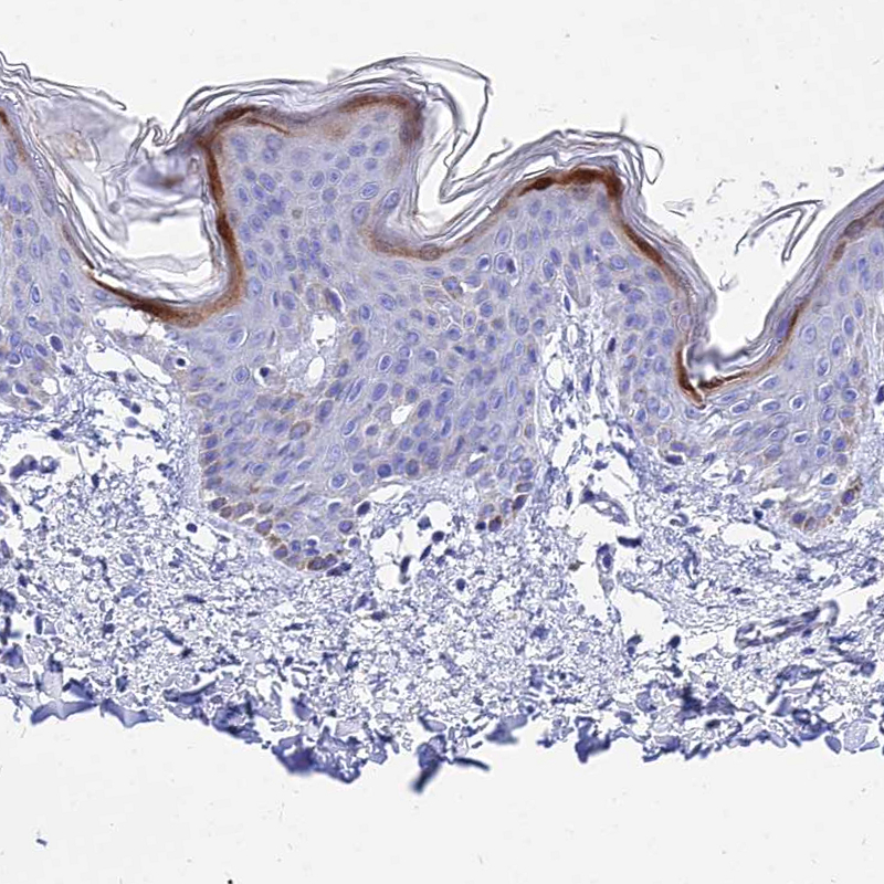 Anti-CARD18 Antibody