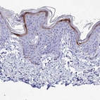 Anti-CARD18 Antibody