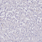 Anti-CARD18 Antibody