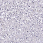 Immunohistochemical staining of human liver shows no cytoplasmic positivity in hepatocytes as expected.