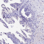 Immunohistochemical staining of human prostate shows no cytoplasmic positivity in glandular cells as expected.