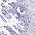 Immunohistochemical staining of human prostate shows no cytoplasmic positivity in glandular cells as expected.