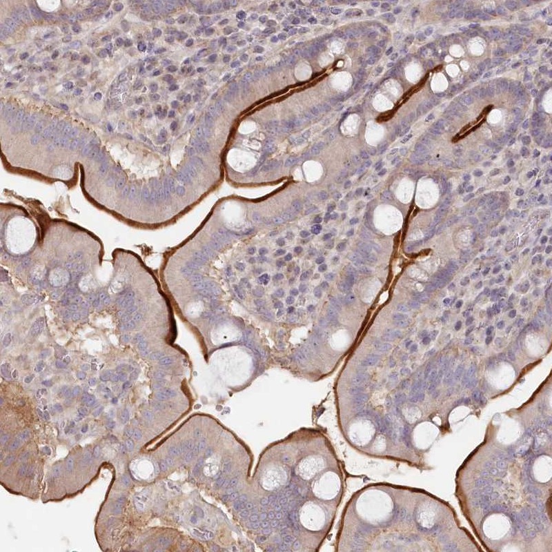 Anti-TCHP Antibody