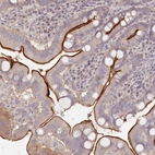 Anti-TCHP Antibody