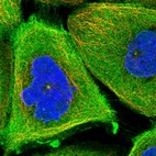 Immunofluorescent staining of human cell line A-431 shows localization to plasma membrane, cytosol & centrosome.