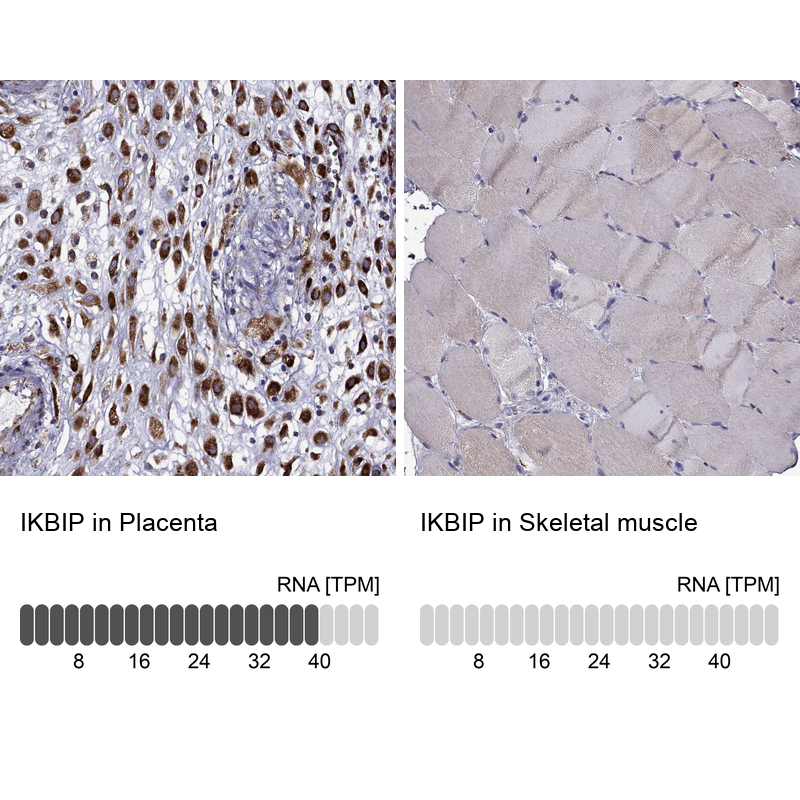Anti-IKBIP Antibody